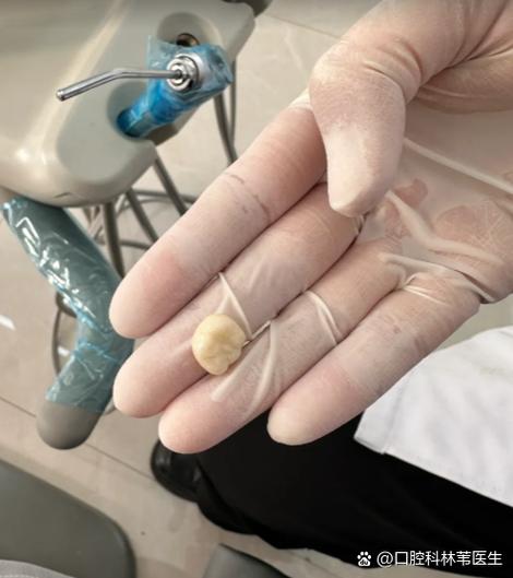 拜博口腔种植牙脱落为何发生？真相待解-图2