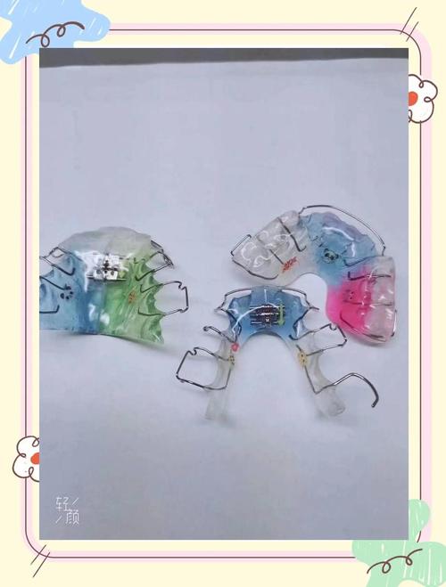 双曲舌簧矫治器制作方法-图2