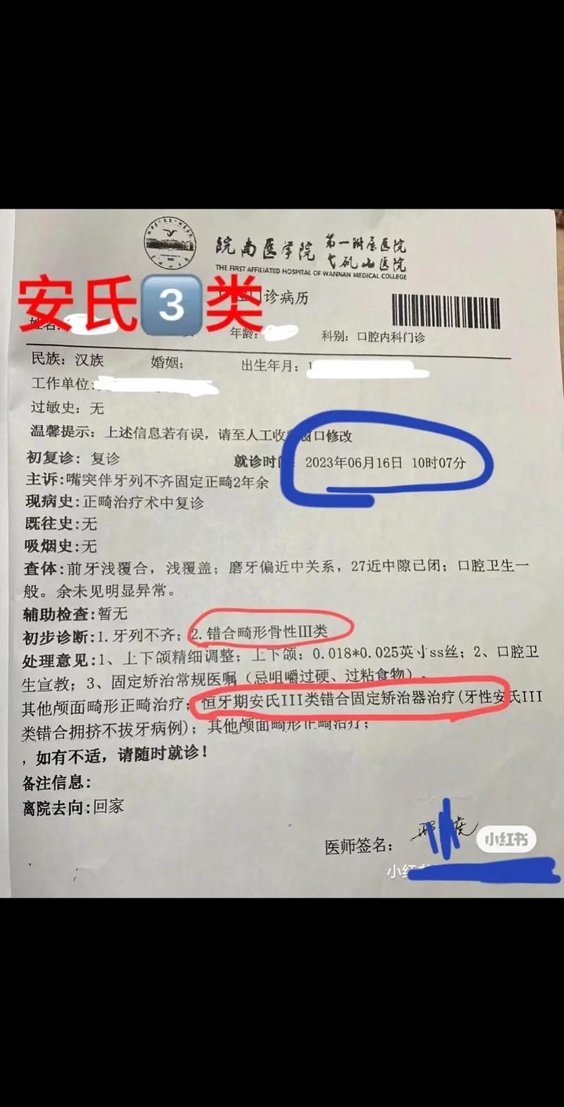 正畸安氏二类一分类病例的矫治要点有哪些？-图1