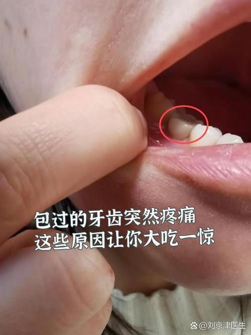 种牙后为何其它牙齿不舒服？是正常反应还是邻牙受影响？需要处理吗？-图1