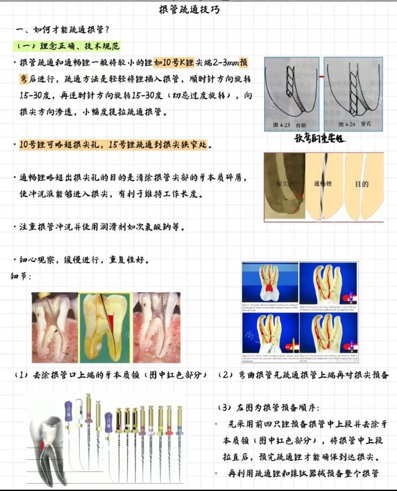 根测仪使用方法及注意事项有哪些关键操作点？-图2