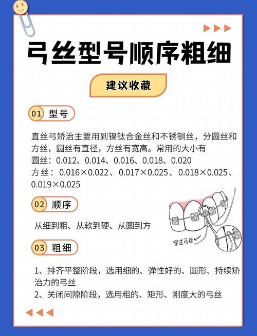 正畸弓丝为什么要烧一下?-图1 正畸弓丝为什么要烧一下?-图1