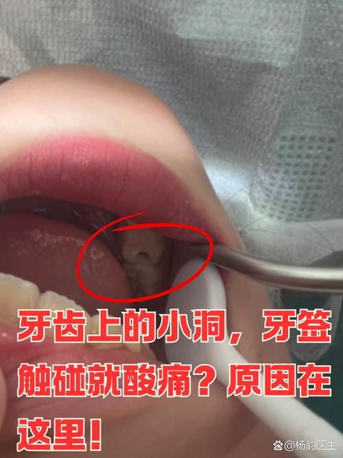 种牙术后口腔感觉有味道?原因分析与护理建议-图2 种牙术后口腔感觉有味道?原因分析与护理建议-图2