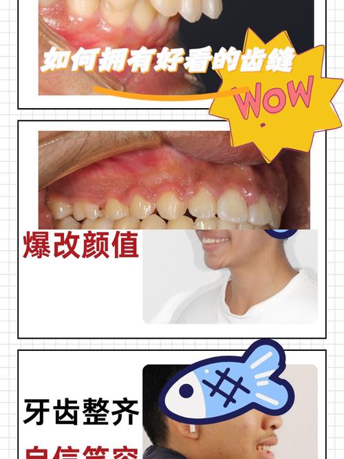 佛山市口腔医院进修正畸项目具体有何优势？效果与服务怎么样？-图1