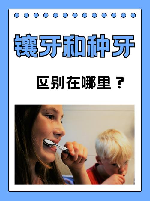 瑞典镶牙VS种牙，哪个更好？优缺点对比如何科学选？-图3