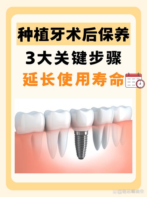 种牙后能用多少年?影响使用寿命的关键因素有哪些?-图2 种牙后能用多少年?影响使用寿命的关键因素有哪些?-图2