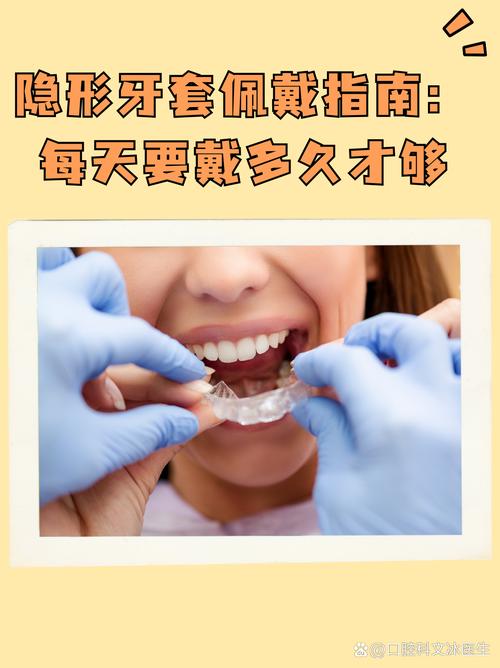 隐形正畸牙套一般要戴多长时间？-图2