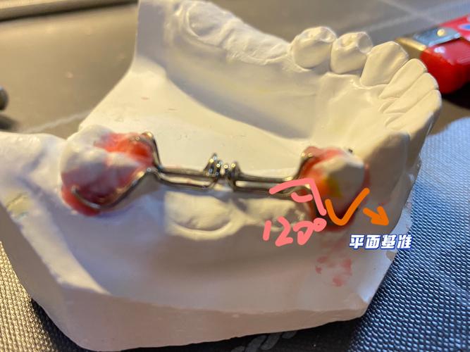 如何弯制三臂卡环?图谱方法步骤有哪些?-图2 如何弯制三臂卡环?图谱方法步骤有哪些?-图2