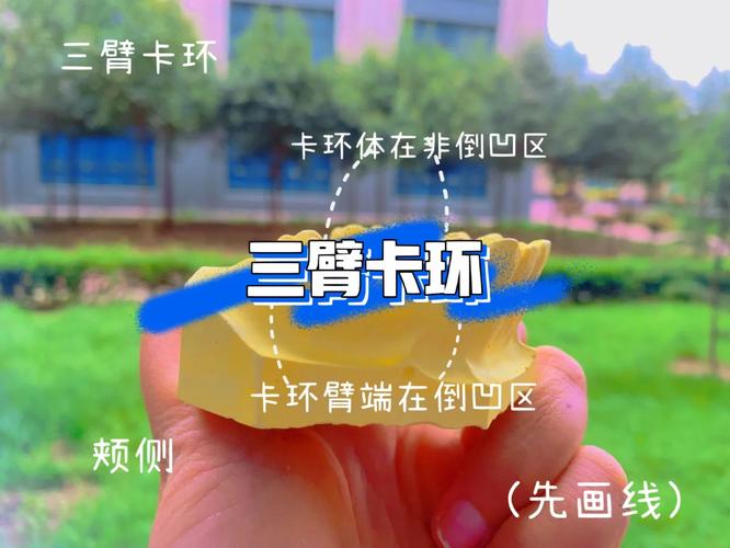 如何弯制三臂卡环?图谱方法步骤有哪些?-图1 如何弯制三臂卡环?图谱方法步骤有哪些?-图1