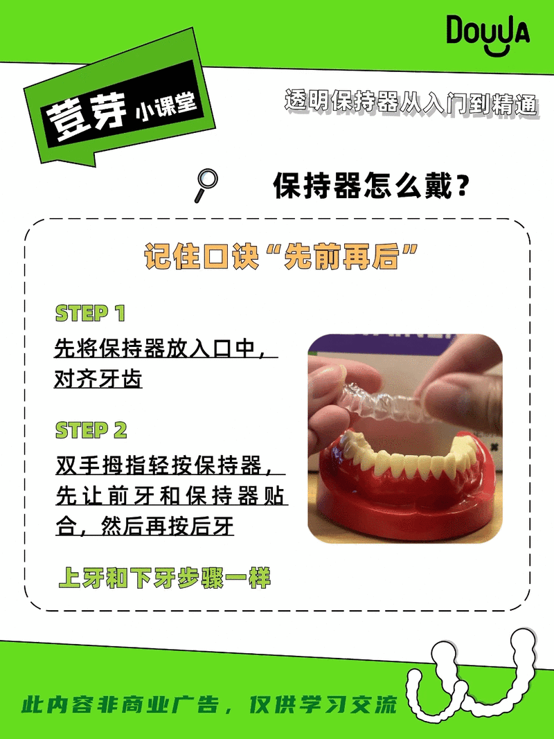 透明牙套怎么取才正确?正确方法是什么?取错会伤牙套吗?-图1 透明牙套怎么取才正确?正确方法是什么?取错会伤牙套吗?-图1