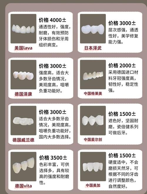 杭州种牙哪个好？格莱美种植牙靠谱吗？-图2