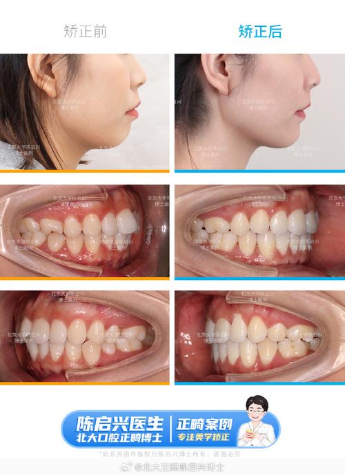 北大口腔医院正畸人多吗-图2
