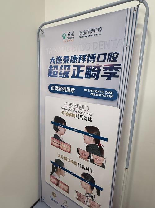 拜博口腔官网矫治效果如何?流程与价格透明吗?-图2 拜博口腔官网矫治效果如何?流程与价格透明吗?-图2