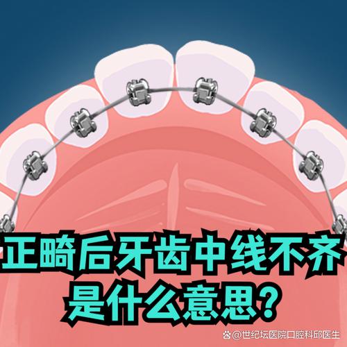 矫正中线不齐的具体方法有哪些？-图2