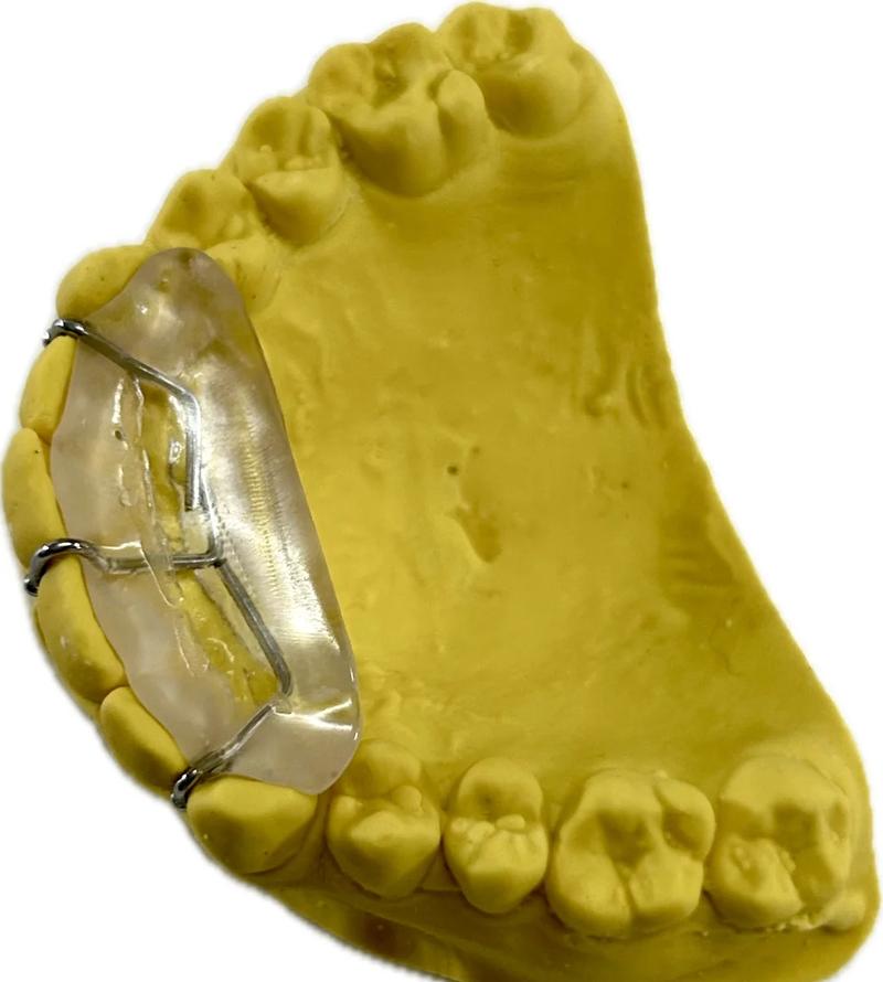 正畸平导是厚的还是薄的-图1