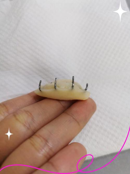 正畸平导是厚的还是薄的-图3