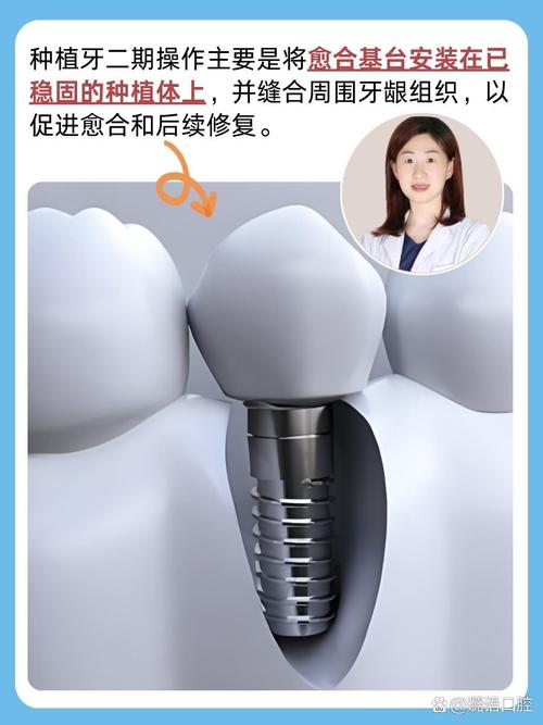 种牙后旁牙紧是怎么回事？原因探究-图3