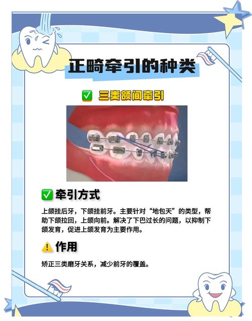 中医牙齿矫正方法有哪些?传统中医矫正具体方法有哪些?-图1 中医牙齿矫正方法有哪些?传统中医矫正具体方法有哪些?-图1