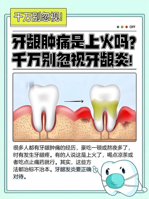 牙龈炎前期有哪些治疗方法？早期牙龈炎如何科学干预？-图3