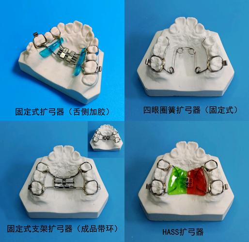 牙齿矫正扩弓器如何正确使用？操作步骤、方法及注意事项有哪些？-图1