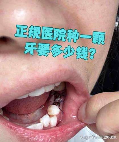 常州102医院种牙好不好?真实体验如何?-图1 常州102医院种牙好不好?真实体验如何?-图1