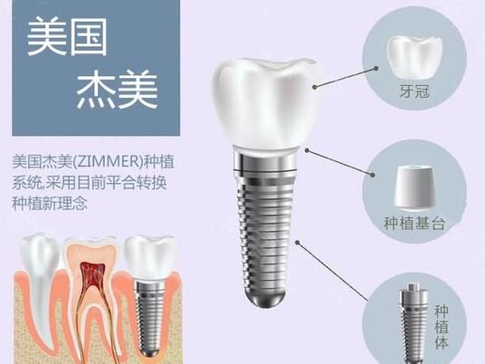 常州102医院种牙好不好？真实体验如何？-图2