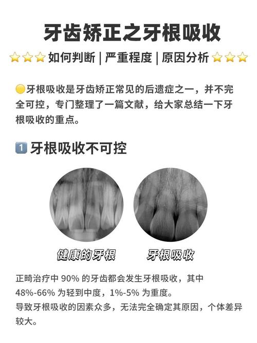 牙槽骨吸收后,还能种牙吗?-图1 牙槽骨吸收后,还能种牙吗?-图1