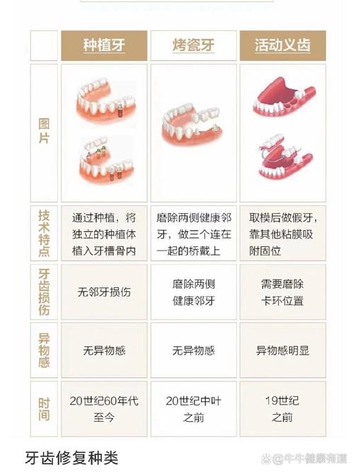 微创种牙与种植牙有何不同?-图1 微创种牙与种植牙有何不同?-图1