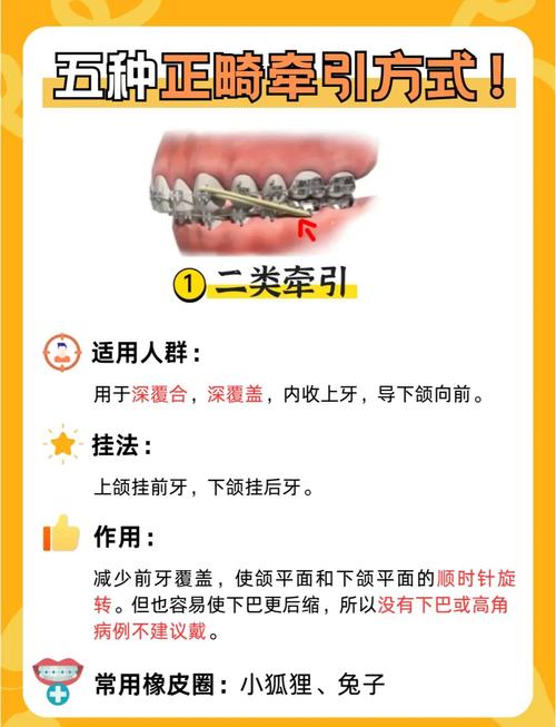 正畸橡皮筋一般需要多长时间更换一次?更换频率高效果更好吗?-图1 正畸橡皮筋一般需要多长时间更换一次?更换频率高效果更好吗?-图1