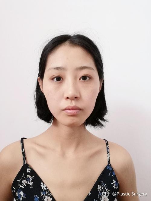 杭州去格莱美种牙的交通路线和就诊流程是什么？-图1