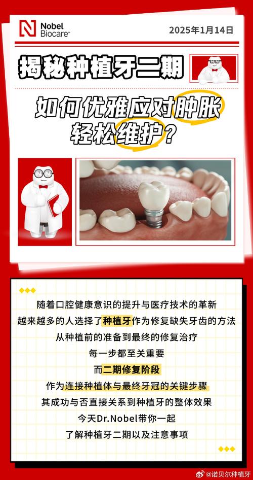 诺贝尔active种牙技术好在哪？-图2