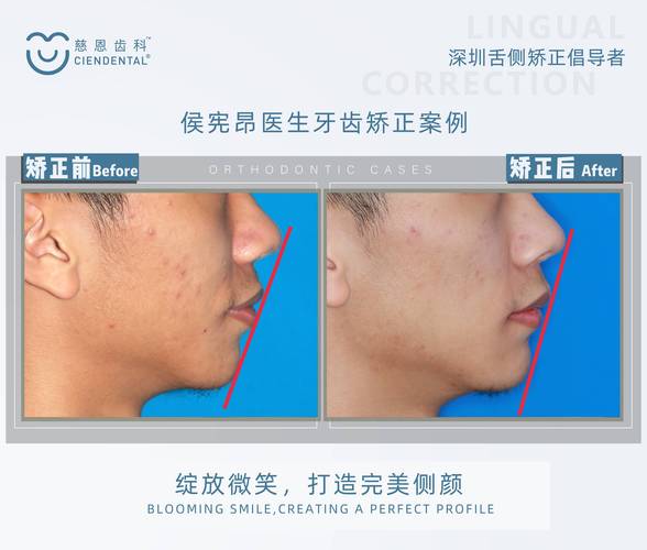 济宁市最好的牙正畸医生如何判断?有哪些靠谱的评判标准?-图1 济宁市最好的牙正畸医生如何判断?有哪些靠谱的评判标准?-图1