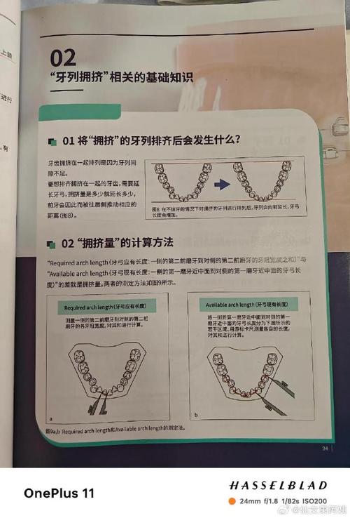 弯制正畸矫治器实验总结-图1
