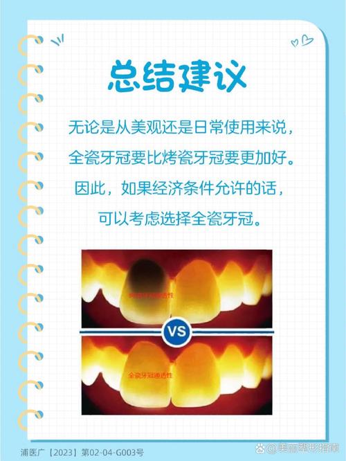 拜博口腔烤瓷牙分哪几种?-图2 拜博口腔烤瓷牙分哪几种?-图2