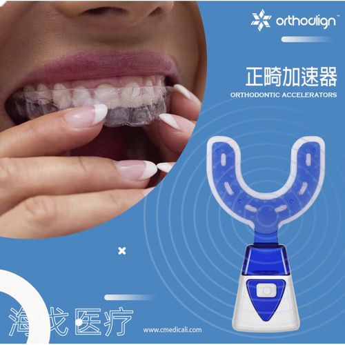 美速达正畸加速器价格是多少?-图1 美速达正畸加速器价格是多少?-图1