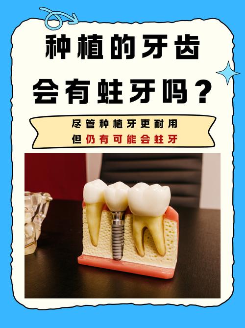 口腔有坏牙为何会影响种牙？-图2