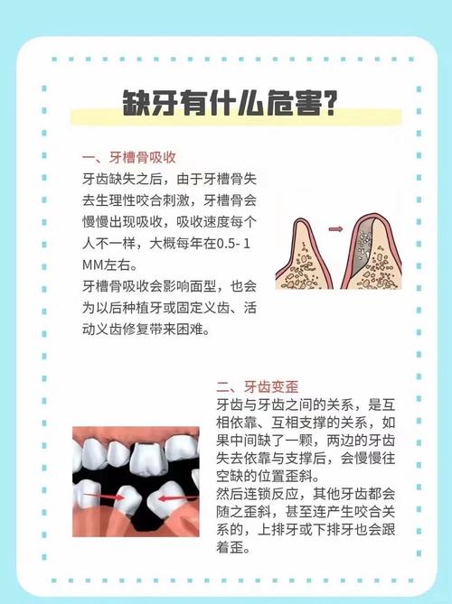口腔有坏牙为何会影响种牙？-图3