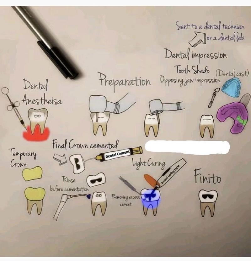 确定牙体预备量的方法有-图3