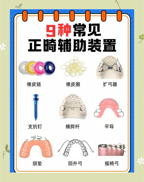 正畸改良基奇顿辅弓的临床应用优势有哪些？-图1