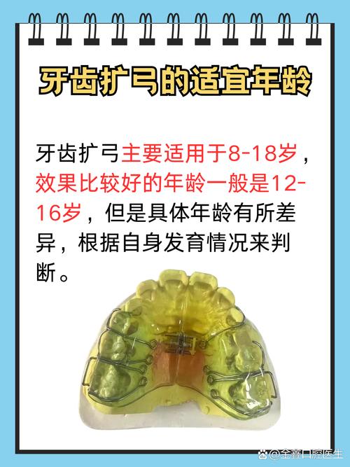 正畸改良基奇顿辅弓的临床应用优势有哪些?-图2 正畸改良基奇顿辅弓的临床应用优势有哪些?-图2