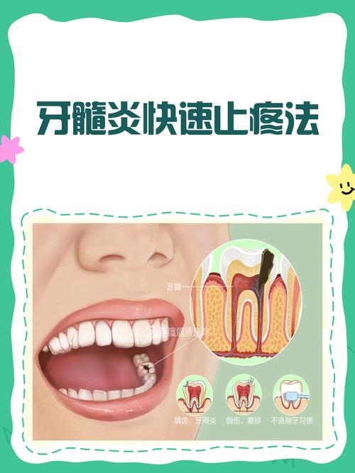 宝宝牙髓炎怎么治疗方法-图2