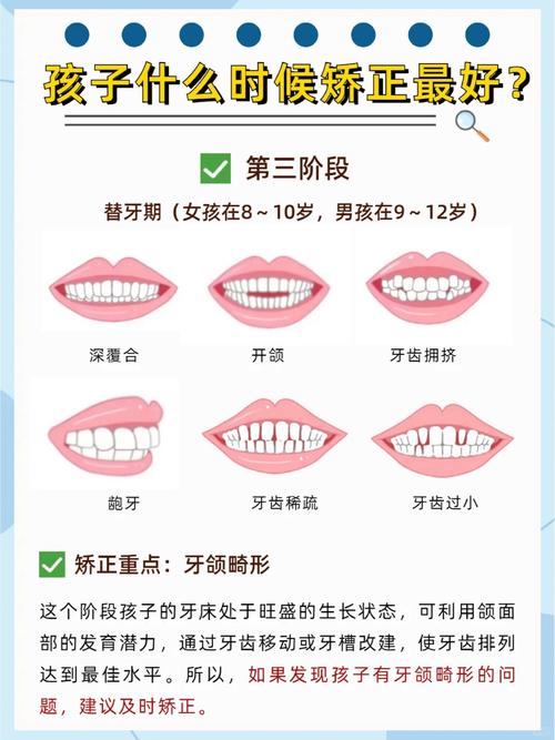 乳牙替牙期矫治方法有哪些？如何把握最佳干预时机？-图1