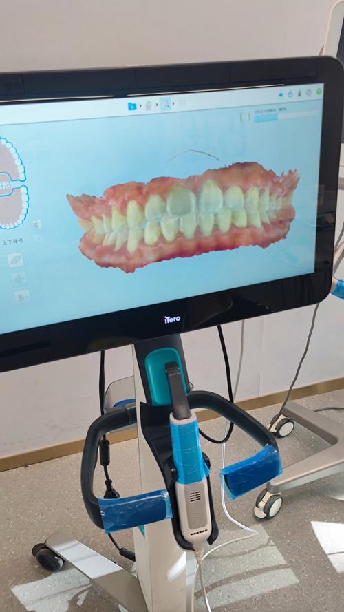 如何通过口腔扫描仪使用方法视频掌握正确操作步骤？-图1
