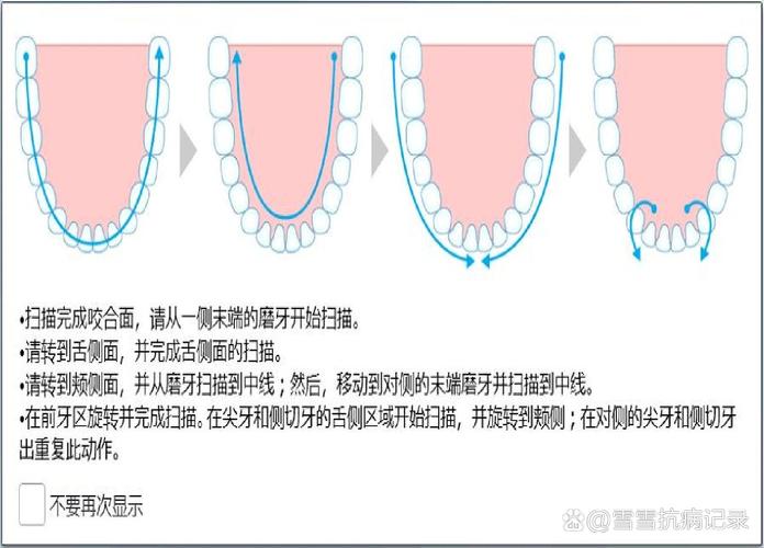 如何通过口腔扫描仪使用方法视频掌握正确操作步骤?-图2 如何通过口腔扫描仪使用方法视频掌握正确操作步骤?-图2