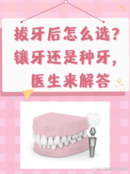 30岁种牙好还是镶牙好-图3 30岁种牙好还是镶牙好-图3