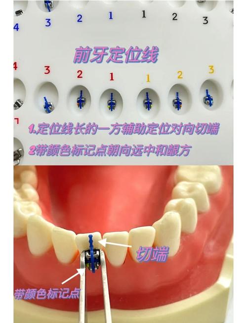 正畸颊面管左右对应牙位-图1