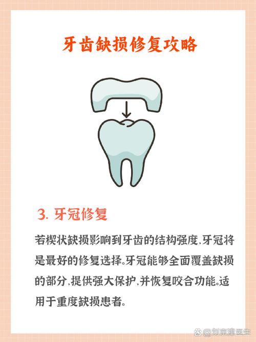 牙体缺损修复方法的选择应依据哪些关键临床因素与患者意愿?-图3 牙体缺损修复方法的选择应依据哪些关键临床因素与患者意愿?-图3