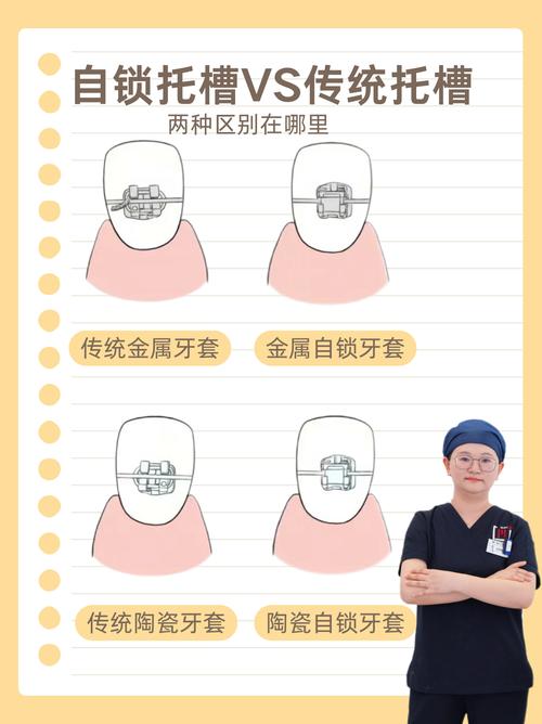 普特自锁托槽的使用方法具体有哪些操作步骤和注意事项？-图1