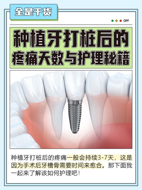 种牙一期后一般疼几天-图1 种牙一期后一般疼几天-图1