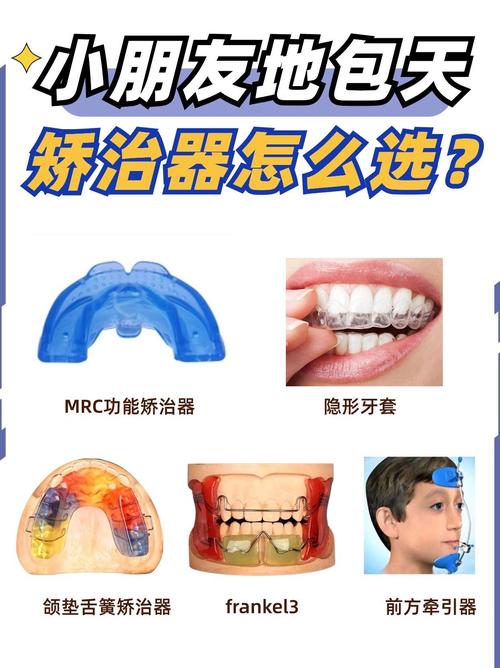 错颌畸形矫正方法有哪几种?不同情况如何选?-图3 错颌畸形矫正方法有哪几种?不同情况如何选?-图3